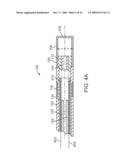 IRRIGATED ABLATION CATHETERS diagram and image