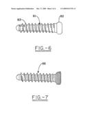 Orthopedic plate for use in fibula repair diagram and image