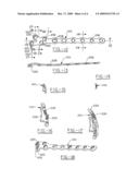 Orthopedic plate for use in fibula repair diagram and image