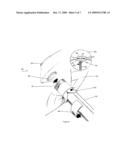 MAGNETIC DEVICES AND METHODS FOR SEPTAL OCCLUSION diagram and image