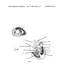 MAGNETIC DEVICES AND METHODS FOR SEPTAL OCCLUSION diagram and image