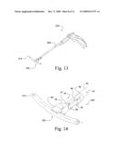 Minimally invasive instruments and methods for inserting implants diagram and image