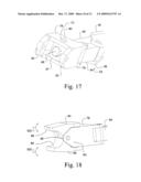 Minimally invasive instruments and methods for inserting implants diagram and image