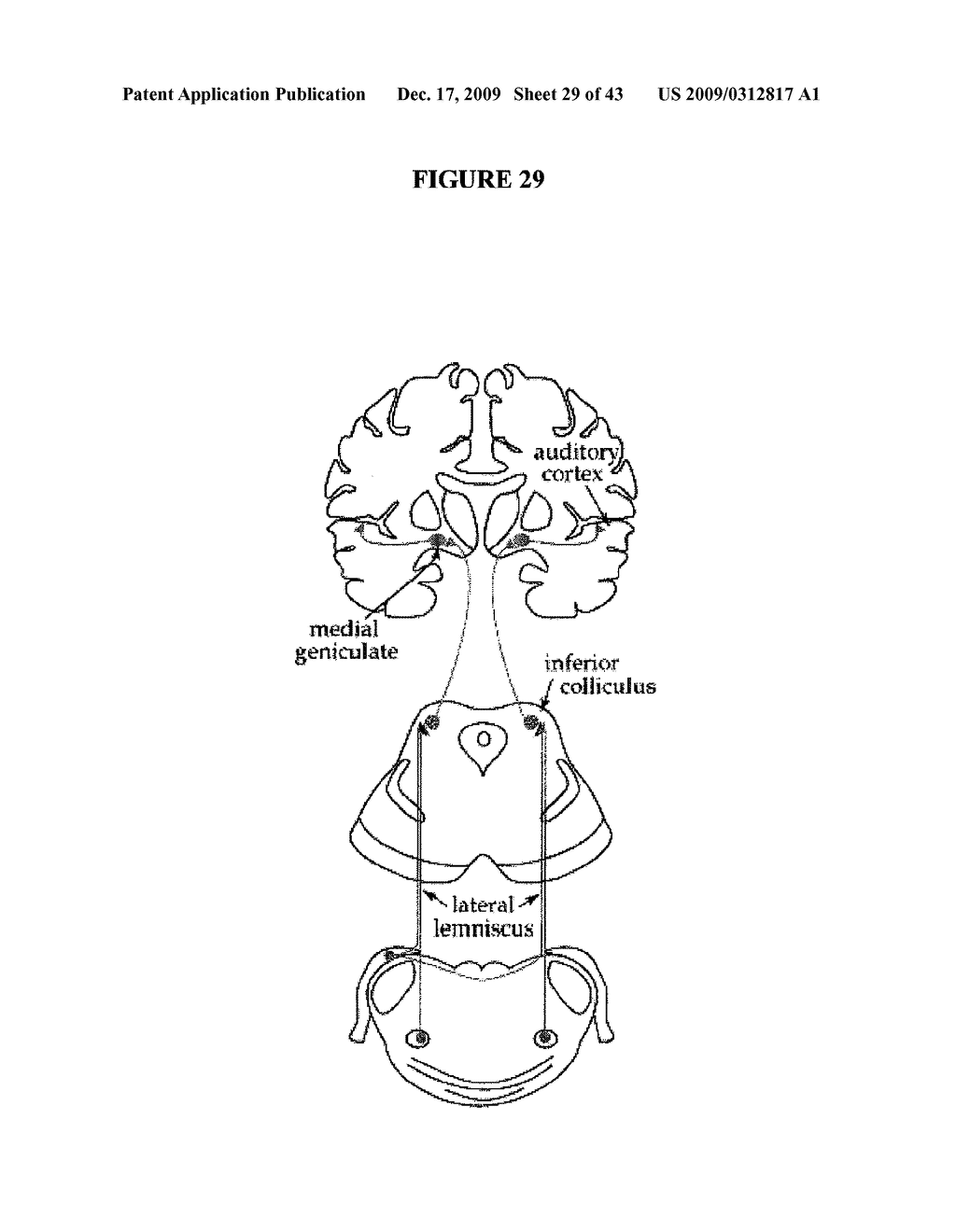 SYSTEMS AND METHODS FOR ALTERING BRAIN AND BODY FUNCTIONS AND FOR TREATING CONDITIONS AND DISEASES OF THE SAME - diagram, schematic, and image 30