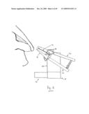 NASAL DELIVERY diagram and image