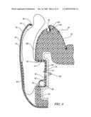 Vehicle Seat Side Air Bag diagram and image