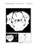 Aqueous Dispersion of Superparamagnetic Single-Domain Particles, Production and Use Thereof in Diagnosis and Therapy diagram and image