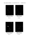 METHOD OF MODIFYING GLUCOSE ACTIVITY USING POLYPEPTIDES SELECTIVELY EXPRESSED IN FAT TISSUE diagram and image