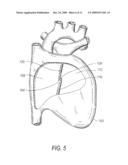 BIOENGINEERED TISSUE CONSTRUCTS AND CARDIAC USES THEREOF diagram and image