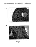 TWO PORE CHANNELS AS REGULATORS OF PROLIFERATION IN CANCER diagram and image