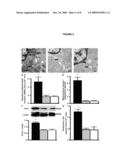 BRONCHIAL SMOOTH MUSCLE REMODELING INVOLVES CALCIUM-DEPENDENT ENHANCED MITOCHONDRIAL BIOGENESIS IN ASTHMA diagram and image
