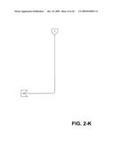 Neoplastic cell destruction device and method utilizing low frequency sound waves to disrupt or displace cellular materials diagram and image