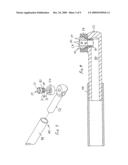 Suction ablator diagram and image