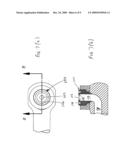 Suction ablator diagram and image