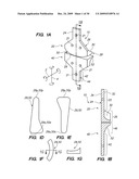 IMPLANTABLE BRACE FOR PROVIDING JOINT SUPPORT diagram and image