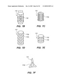 IMPLANTABLE BRACE FOR PROVIDING JOINT SUPPORT diagram and image