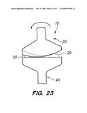 IMPLANTABLE BRACE FOR PROVIDING JOINT SUPPORT diagram and image