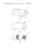 EXTERNAL PACEMAKER WITH AUTOMATIC CARDIOPROTECTIVE PACING PROTOCOL diagram and image