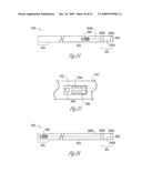 EXTERNAL PACEMAKER WITH AUTOMATIC CARDIOPROTECTIVE PACING PROTOCOL diagram and image