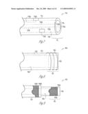 PACING CATHETER RELEASING CONDUCTIVE LIQUID diagram and image