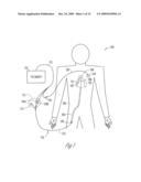 TRANSVASCULAR BALLOON CATHETER WITH PACING ELECTRODES ON SHAFT diagram and image