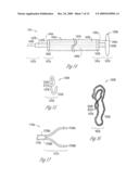 TRANSVASCULAR BALLOON CATHETER WITH PACING ELECTRODES ON SHAFT diagram and image