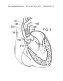 RETAINING MECHANISMS FOR PROSTHETIC VALVES diagram and image