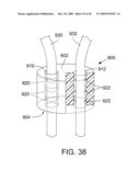 RETAINING MECHANISMS FOR PROSTHETIC VALVES diagram and image