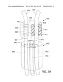 RETAINING MECHANISMS FOR PROSTHETIC VALVES diagram and image