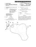 OSTEOCHONDRAL PLUG GRAFT, KIT AND METHOD diagram and image