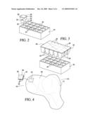 OSTEOCHONDRAL PLUG GRAFT, KIT AND METHOD diagram and image