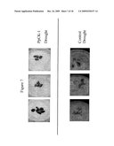 Protein Kinase Stress-Related Proteins and Methods of Use in Plants diagram and image