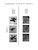 Protein Kinase Stress-Related Proteins and Methods of Use in Plants diagram and image