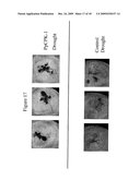 Protein Kinase Stress-Related Proteins and Methods of Use in Plants diagram and image