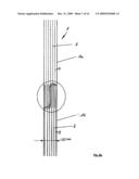 Method and Device for Bundling Steel Coils and Binding Tape for this diagram and image