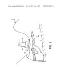 Tracheostomy Tube diagram and image