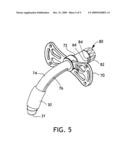 Tracheostomy Tube diagram and image