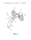 Tracheostomy Tube diagram and image