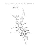 Fastening Device diagram and image