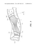 Inserts for engine exhaust systems diagram and image