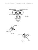 Dental handpiece performance sensor diagram and image