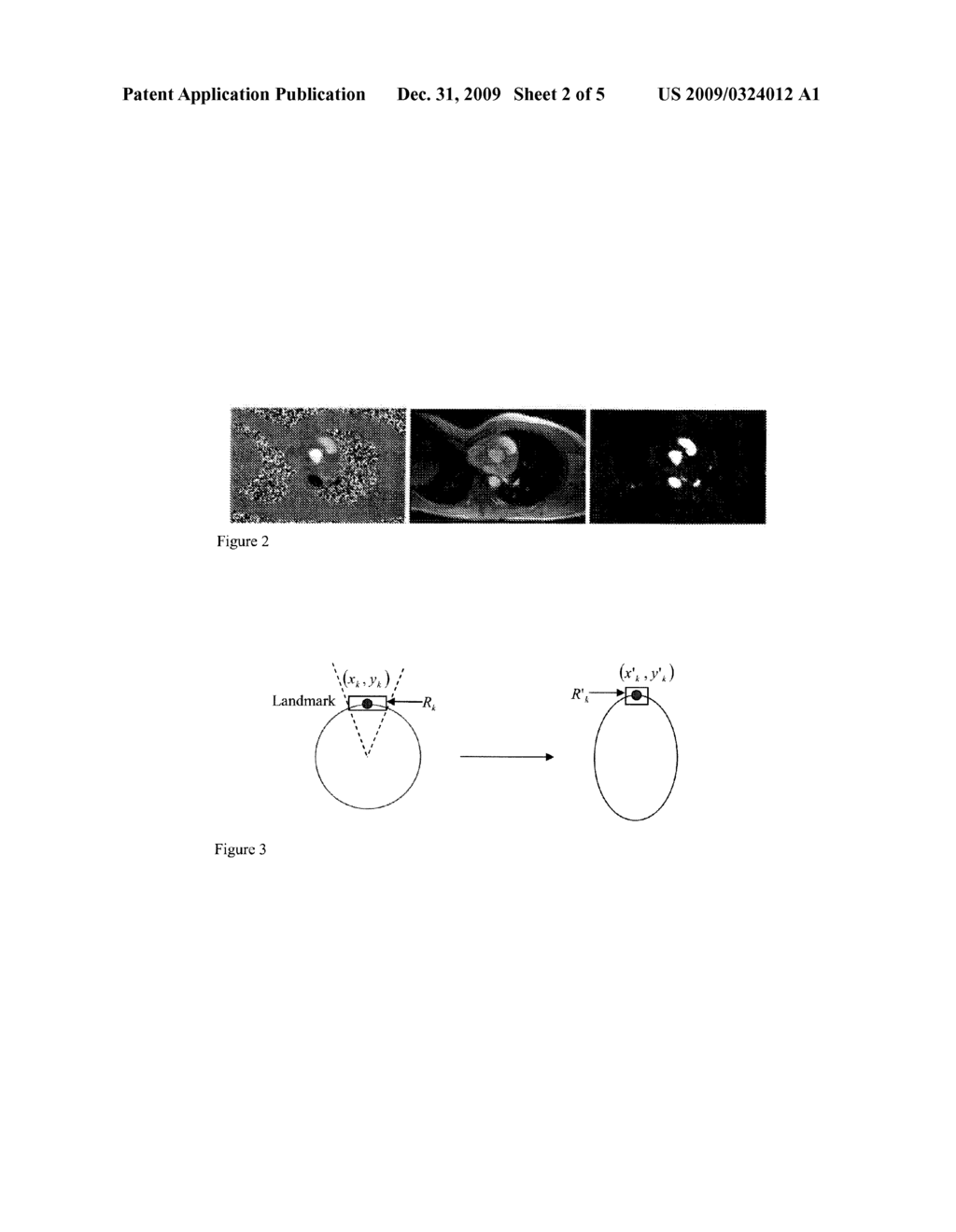 SYSTEM AND METHOD FOR CONTOUR TRACKING IN CARDIAC PHASE CONTRAST FLOW MR IMAGES - diagram, schematic, and image 03