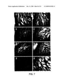 METHOD FOR THE TREATMENT OF INFLAMMATORY DISORDERS diagram and image