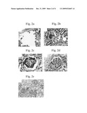 Therapeutic Transplantation Using Developing, Human or Porcine, Renal or Hepatic, Grafts diagram and image