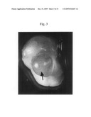 Therapeutic Transplantation Using Developing, Human or Porcine, Renal or Hepatic, Grafts diagram and image