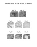 Therapeutic Transplantation Using Developing, Human or Porcine, Renal or Hepatic, Grafts diagram and image