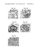 Therapeutic Transplantation Using Developing, Human or Porcine, Renal or Hepatic, Grafts diagram and image