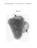 Therapeutic Transplantation Using Developing, Human or Porcine, Renal or Hepatic, Grafts diagram and image