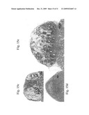 Therapeutic Transplantation Using Developing, Human or Porcine, Renal or Hepatic, Grafts diagram and image