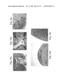 Therapeutic Transplantation Using Developing, Human or Porcine, Renal or Hepatic, Grafts diagram and image